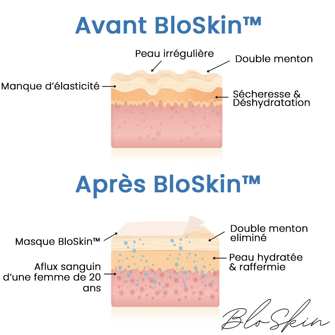 Le BloSkin™ Lift (2)